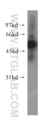13104-1-AP - CBLC / RNF57