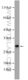 18282-1-AP - CCDC85B / DIPA