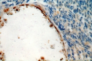 18160-1-AP - CD248 / TEM1