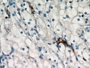 18160-1-AP - CD248 / TEM1