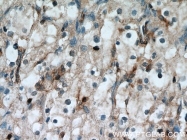 18160-1-AP - CD248 / TEM1
