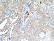 18160-1-AP - CD248 / TEM1