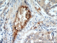 18160-1-AP - CD248 / TEM1