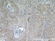 18160-1-AP - CD248 / TEM1