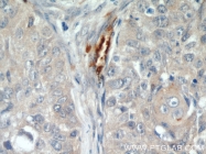 18160-1-AP - CD248 / TEM1
