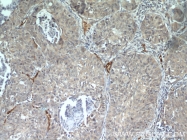18160-1-AP - CD248 / TEM1