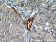 18160-1-AP - CD248 / TEM1