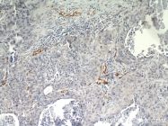 18160-1-AP - CD248 / TEM1