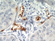 18160-1-AP - CD248 / TEM1