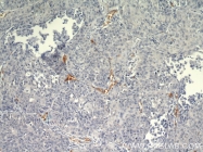 18160-1-AP - CD248 / TEM1