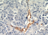 18160-1-AP - CD248 / TEM1
