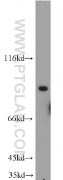 18160-1-AP - CD248 / TEM1