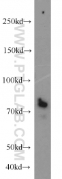 18160-1-AP - CD248 / TEM1