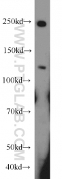 18160-1-AP - CD248 / TEM1