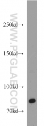 18160-1-AP - CD248 / TEM1