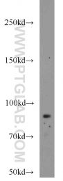 18160-1-AP - CD248 / TEM1