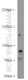 18160-1-AP - CD248 / TEM1