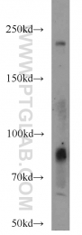 18160-1-AP - CD248 / TEM1