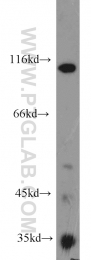 18160-1-AP - CD248 / TEM1