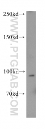 18160-1-AP - CD248 / TEM1