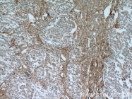 18594-1-AP - CD248 / TEM1