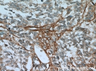 18594-1-AP - CD248 / TEM1