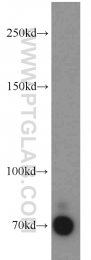 18594-1-AP - CD248 / TEM1