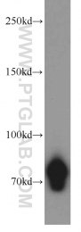 18594-1-AP - CD248 / TEM1