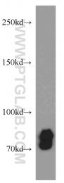 18594-1-AP - CD248 / TEM1