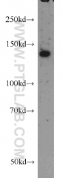 12958-1-AP - RASGRF1