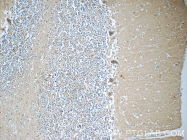 18037-1-AP - Neuronal acetylcholine receptor subunit beta-3
