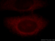 20386-1-AP - Battenin