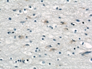 15215-1-AP - TNRC5 / CNPY3
