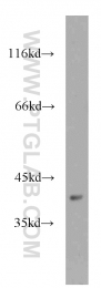15215-1-AP - TNRC5 / CNPY3
