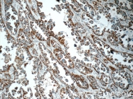 11448-1-AP - Complex IV subunit Va