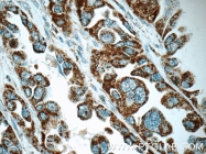 11448-1-AP - Complex IV subunit Va