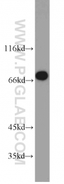 10441-1-AP - CRTC1 / MECT1