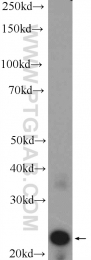 15750-1-AP - Beta-crystallin A2