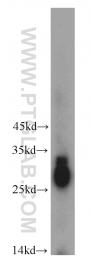 21009-1-AP - Beta-crystallin B3