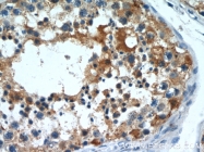 13319-1-AP - UNR protein / CSDE1