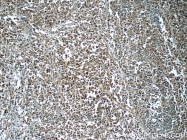 22219-1-AP - XPO2 / Exportin-2