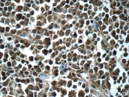 22219-1-AP - XPO2 / Exportin-2