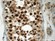 22219-1-AP - XPO2 / Exportin-2