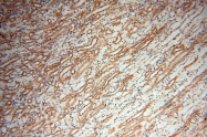 17762-1-AP - GM-CSF