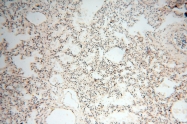 17762-1-AP - GM-CSF