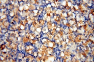 17762-1-AP - GM-CSF