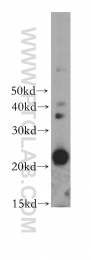 17762-1-AP - GM-CSF