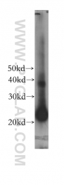 17762-1-AP - GM-CSF