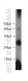 17762-1-AP - GM-CSF