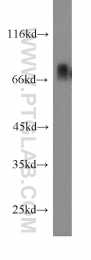 13076-1-AP - DBF4 / ASK